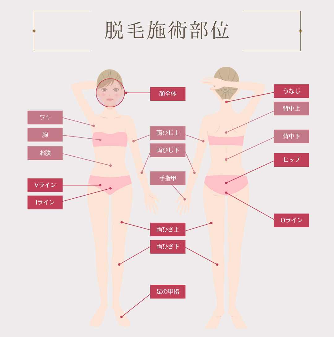 脱毛施術部位